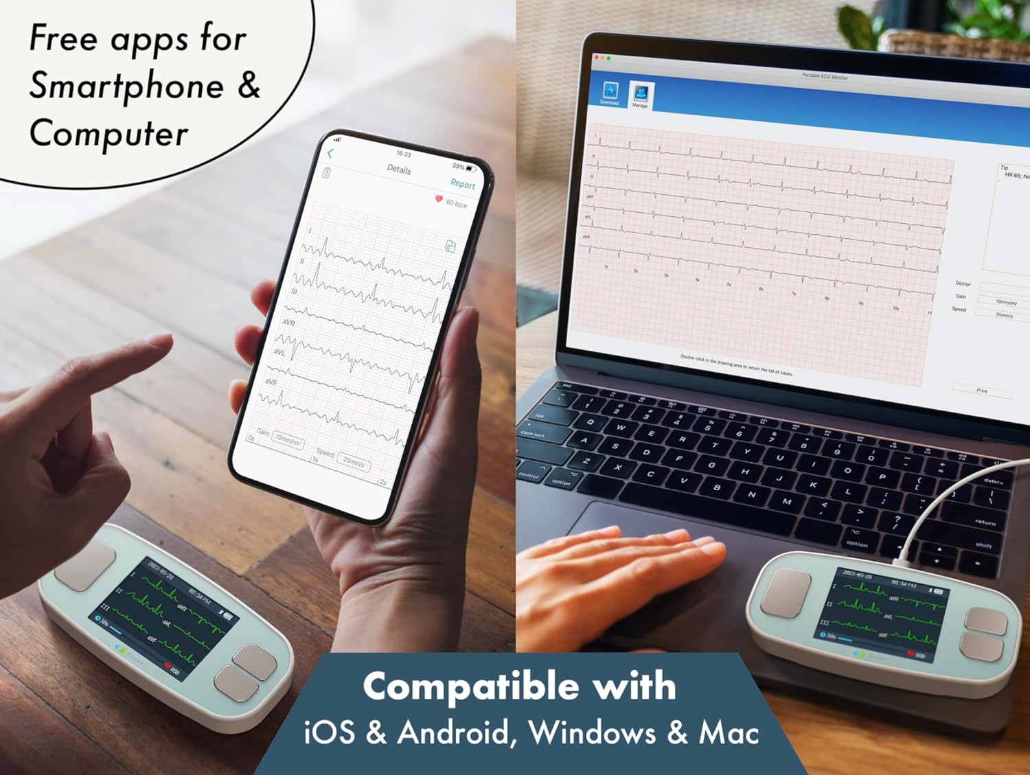 EMAY 6L Portable ECG Monitor | Record ECG and Heart Rate in 6 Channels | Compatible with Smartphone and PC | No Subscription Required - Image 9